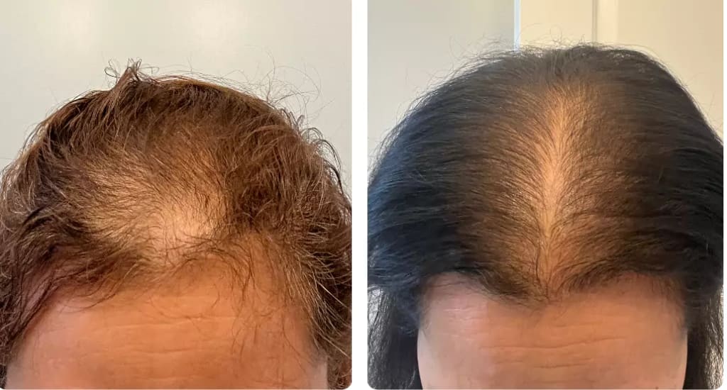 Hair Revive Gummies