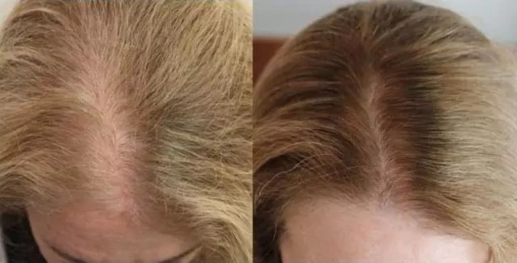 Hair Revive Gummies