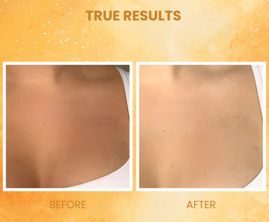 Vivatra Exfoliating Gel